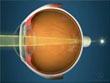 View General Eye Topic Videos